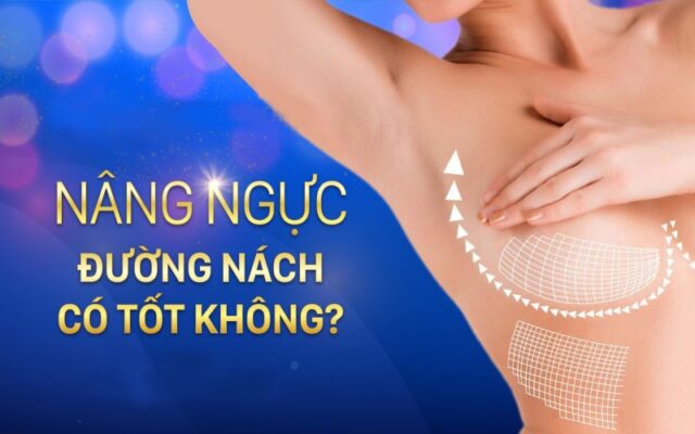 Nâng ngực nội soi đường nách có an toàn không?