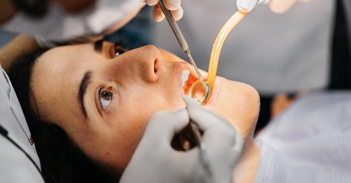 Lấy tủy răng uy tín tại hcm