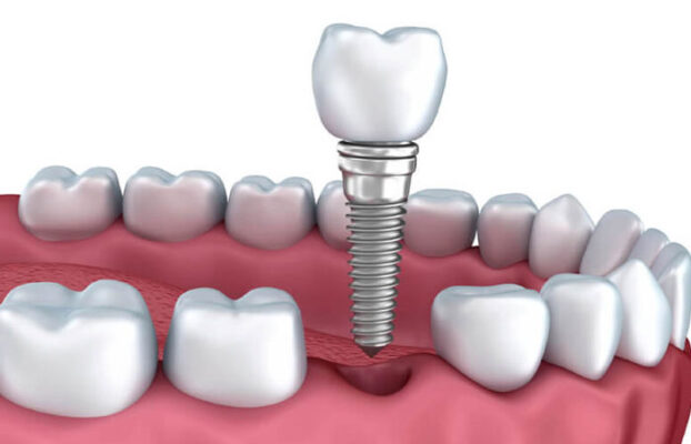 trong rang su tham my