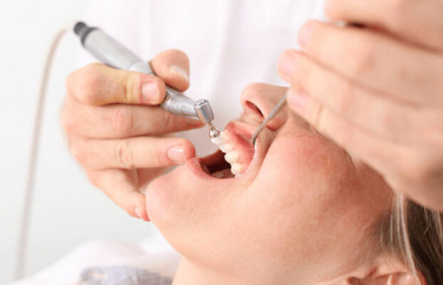 lay cao rang gia bao nhieu