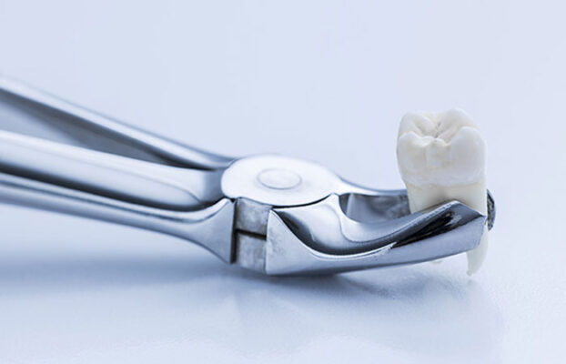 nho rang khon dau may ngay