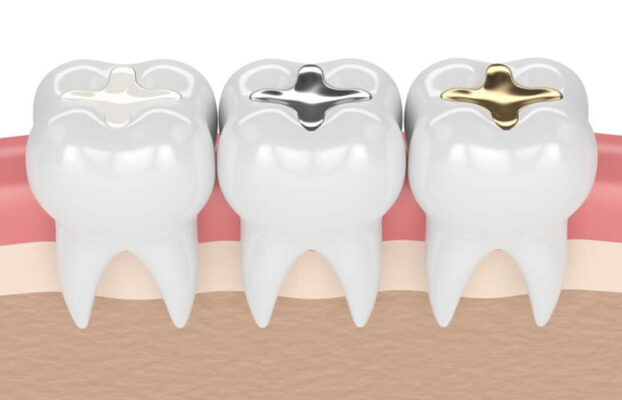 tram rang bao nhieu tien